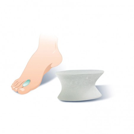 raddrizza alluce in gel polimerico